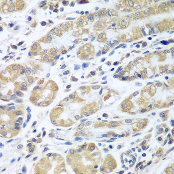EIF1AX Rabbit Polyclonal Antibody - Image 2
