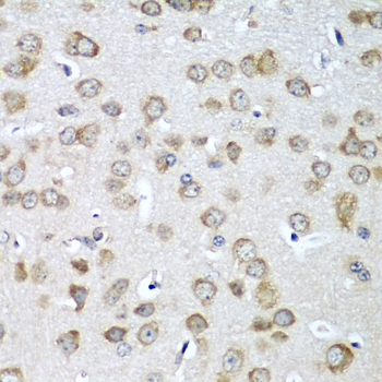 EIF1AX Rabbit Polyclonal Antibody - Image 3