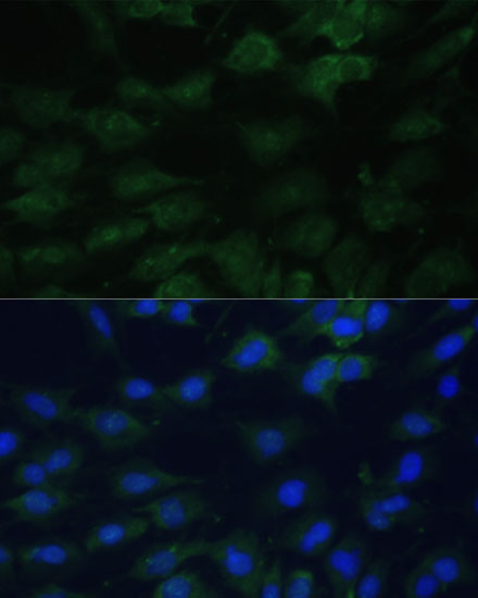EIF1AX Rabbit Polyclonal Antibody - Image 4
