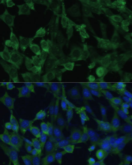EIF1AX Rabbit Polyclonal Antibody - Image 5