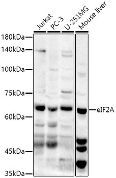 eIF2A Rabbit Polyclonal Antibody