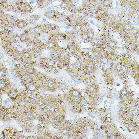 EIF2AK1 Rabbit Polyclonal Antibody - Image 3