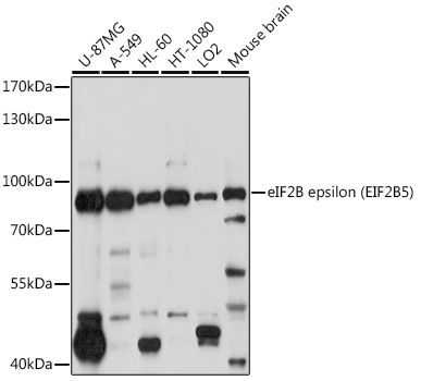 eIF2B epsilon (EIF2B5) Rabbit Polyclonal Antibody