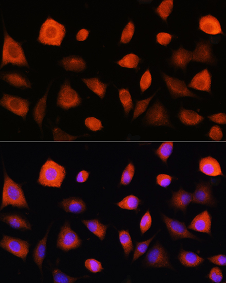 eIF2B epsilon (EIF2B5) Rabbit Polyclonal Antibody - Image 2