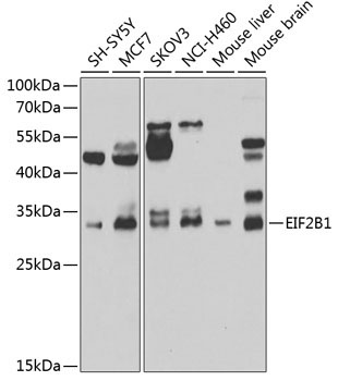 EIF2B1 Rabbit Polyclonal Antibody