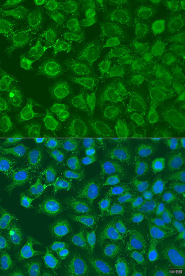 EIF2B1 Rabbit Polyclonal Antibody - Image 2