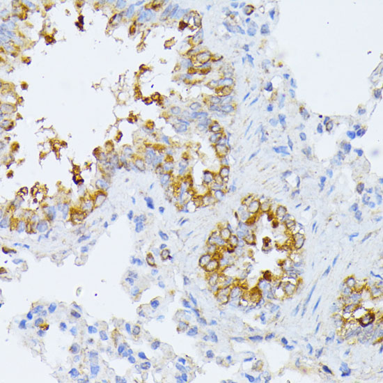 EIF2B2 Rabbit Polyclonal Antibody - Image 2
