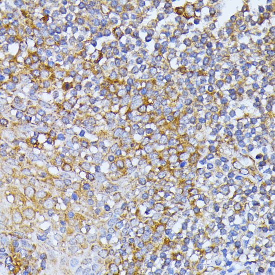 EIF2B2 Rabbit Polyclonal Antibody - Image 3