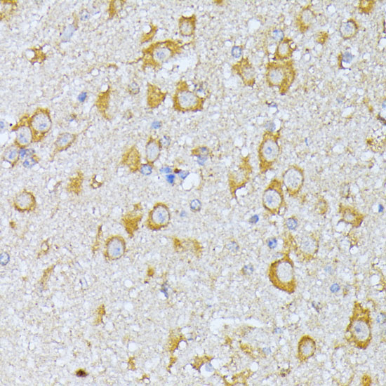 EIF2B2 Rabbit Polyclonal Antibody - Image 4