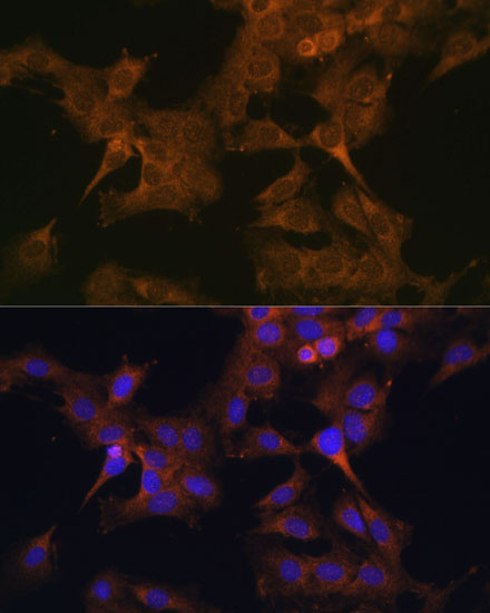 EIF2B2 Rabbit Polyclonal Antibody - Image 5