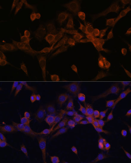 EIF2B2 Rabbit Polyclonal Antibody - Image 6