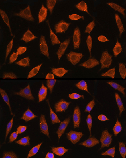 EIF2B4 Rabbit Polyclonal Antibody - Image 2
