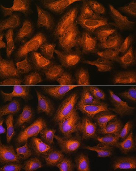 EIF2B4 Rabbit Polyclonal Antibody - Image 3