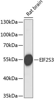 EIF2S3 Rabbit Polyclonal Antibody
