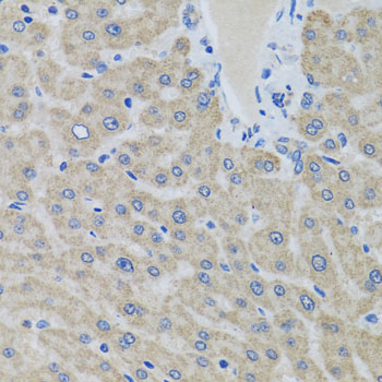 EIF2S3 Rabbit Polyclonal Antibody - Image 2