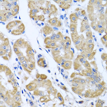 EIF2S3 Rabbit Polyclonal Antibody - Image 3