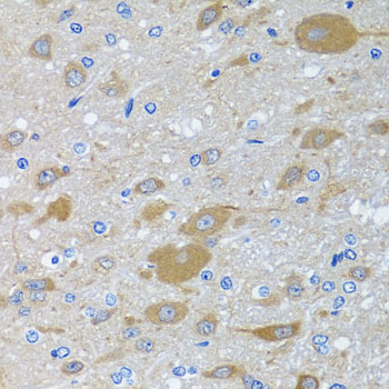EIF2S3 Rabbit Polyclonal Antibody - Image 4