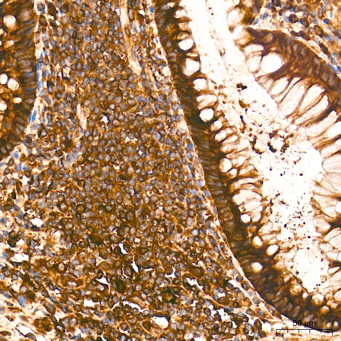 eIF2Alpha Rabbit Polyclonal Antibody - Image 3