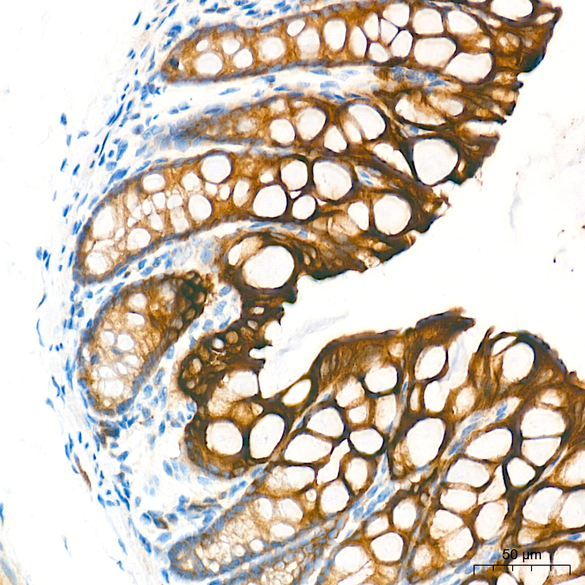 eIF2Alpha Rabbit Polyclonal Antibody - Image 4