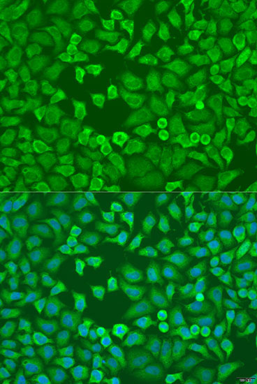 EIF3A Rabbit Polyclonal Antibody - Image 2