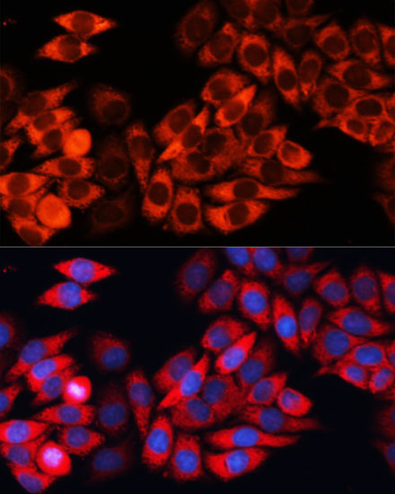 eIF3B Rabbit Polyclonal Antibody - Image 2