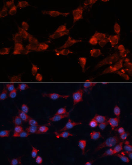 eIF3B Rabbit Polyclonal Antibody - Image 3