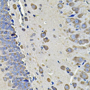EIF3C Rabbit Polyclonal Antibody - Image 2