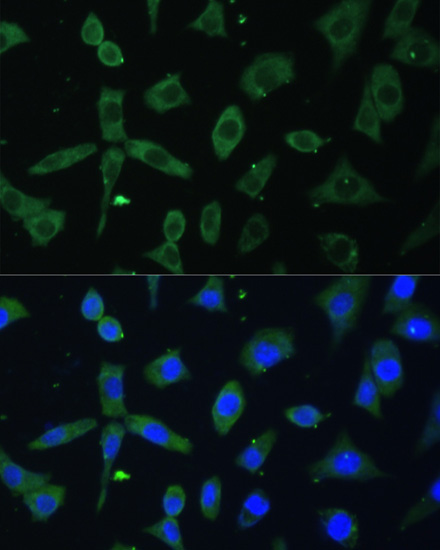 EIF3D Rabbit Polyclonal Antibody - Image 2