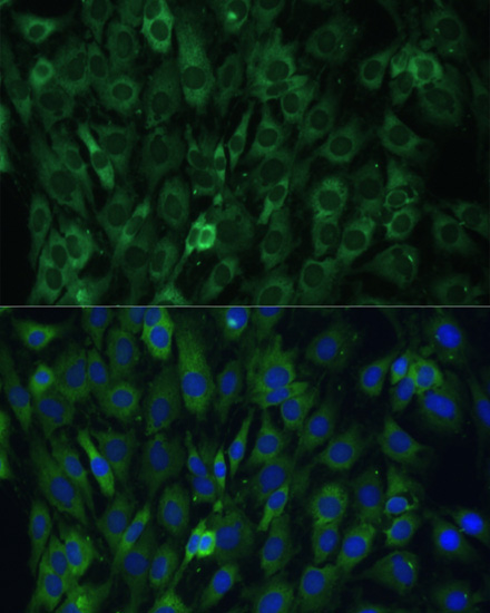 EIF3D Rabbit Polyclonal Antibody - Image 3