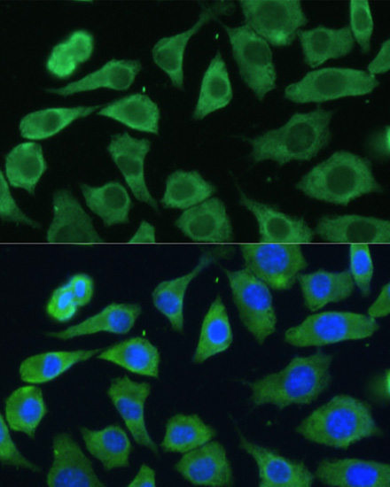 EIF3D Rabbit Polyclonal Antibody - Image 4