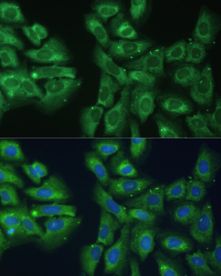 EIF3D Rabbit Polyclonal Antibody - Image 5