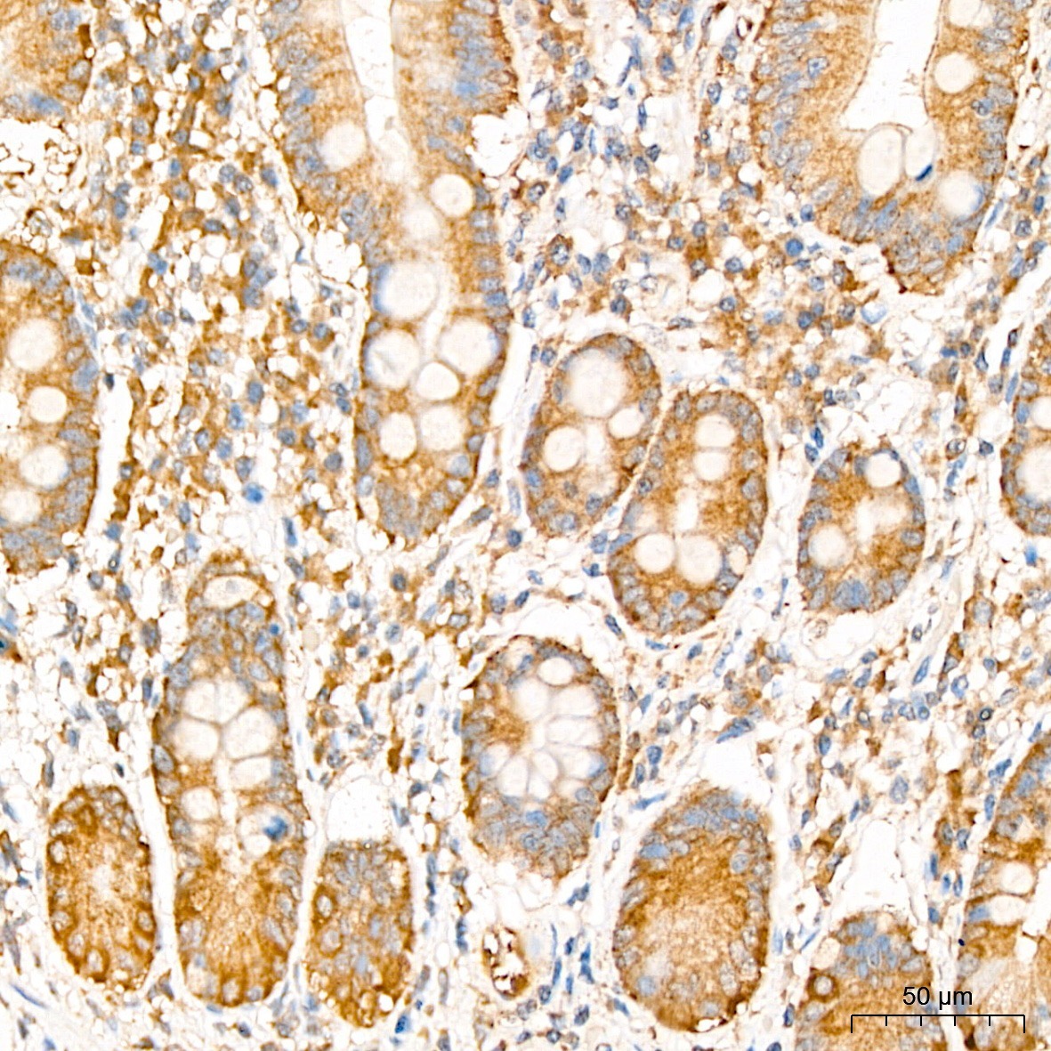 EIF3F Rabbit Polyclonal Antibody - Image 2