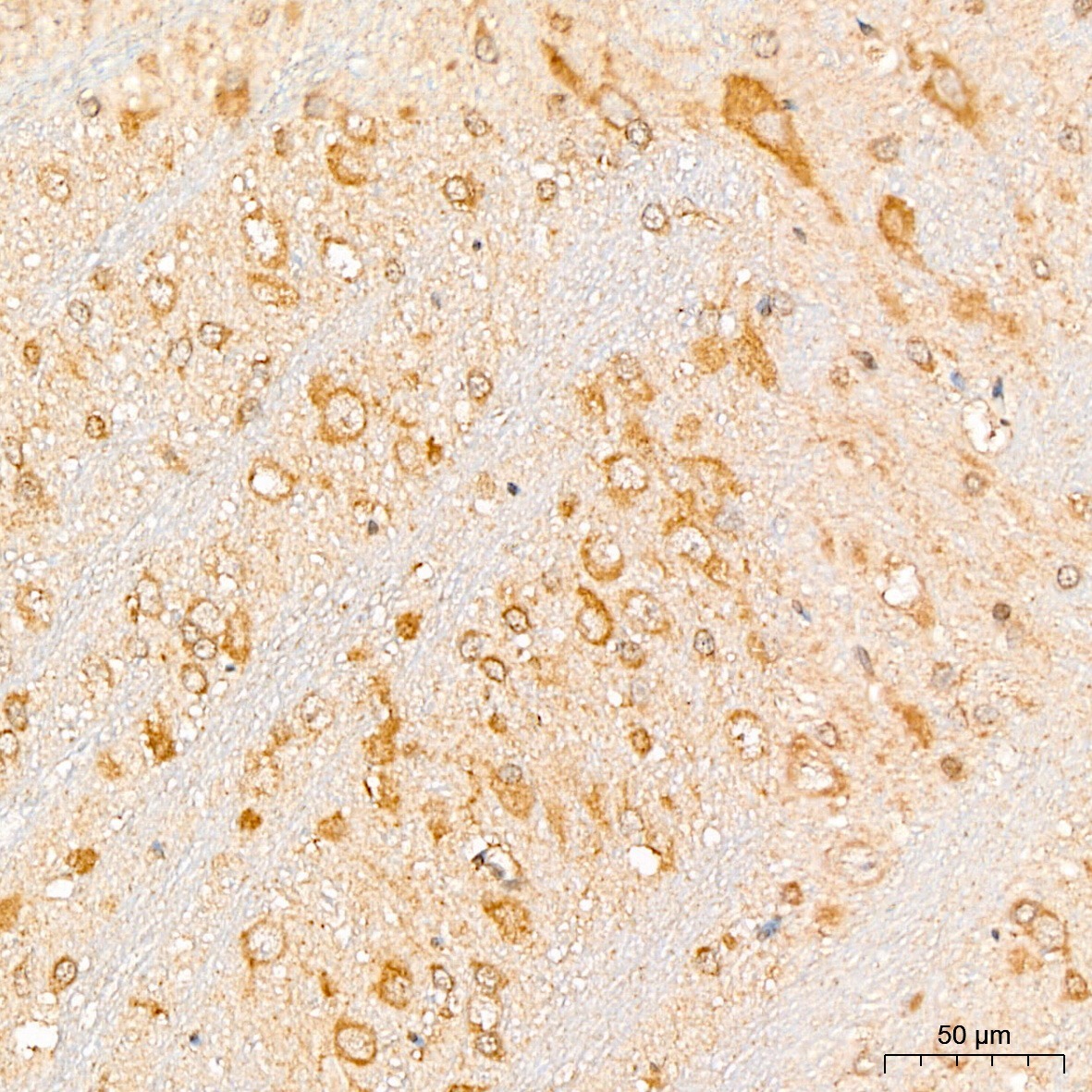 EIF3F Rabbit Polyclonal Antibody - Image 4