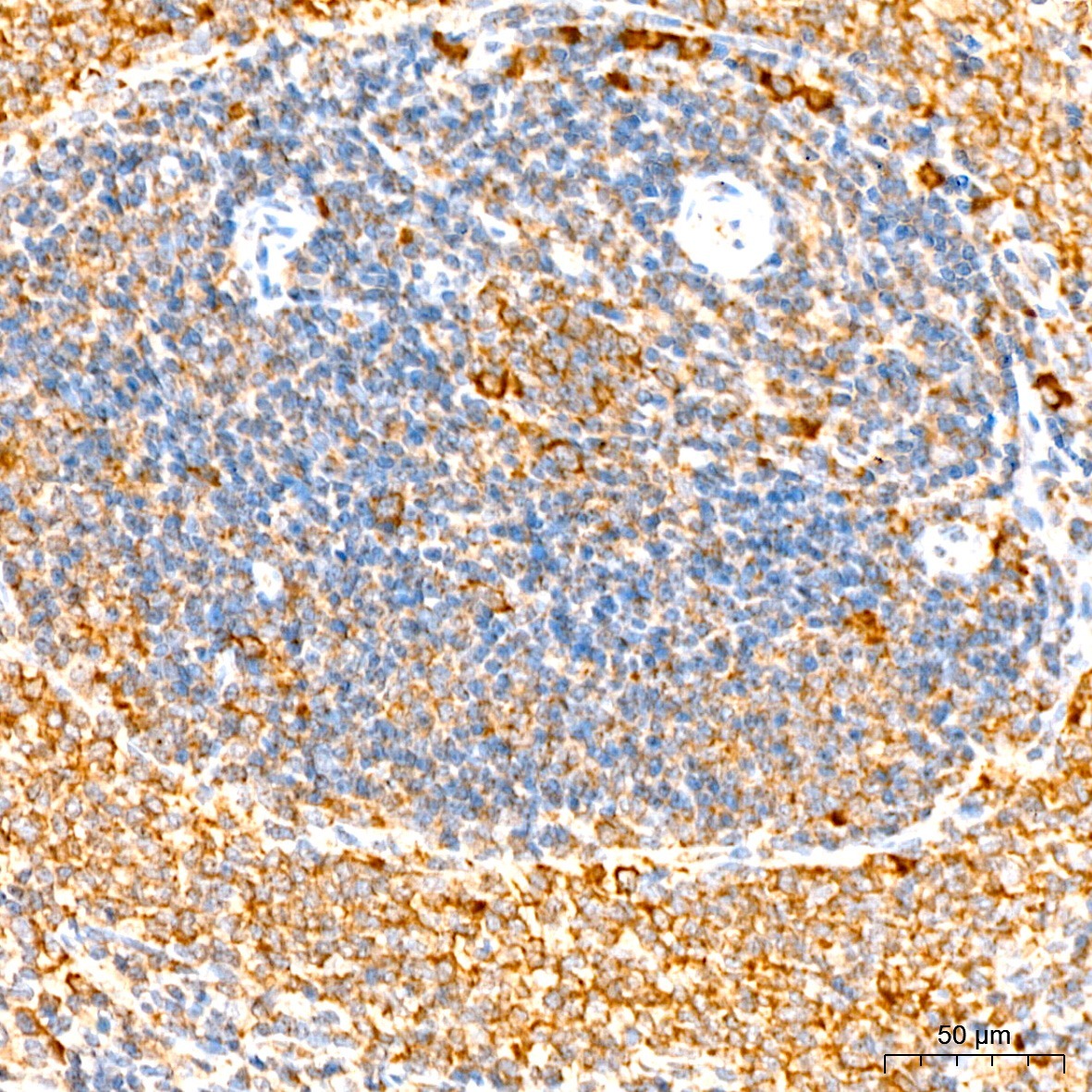 EIF3F Rabbit Polyclonal Antibody - Image 5