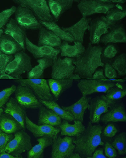 EIF3G Rabbit Polyclonal Antibody - Image 2