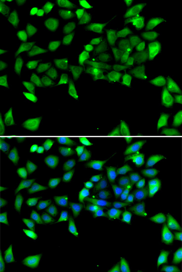 EIF3H Rabbit Polyclonal Antibody - Image 2