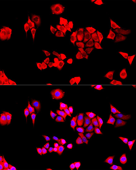 EIF3J Rabbit Polyclonal Antibody - Image 2