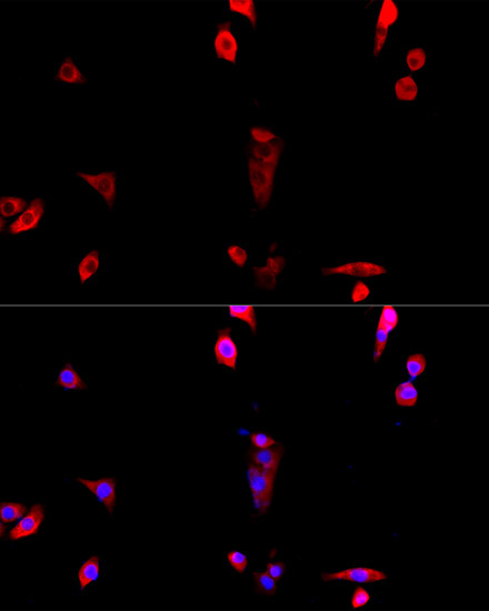 EIF3J Rabbit Polyclonal Antibody - Image 3