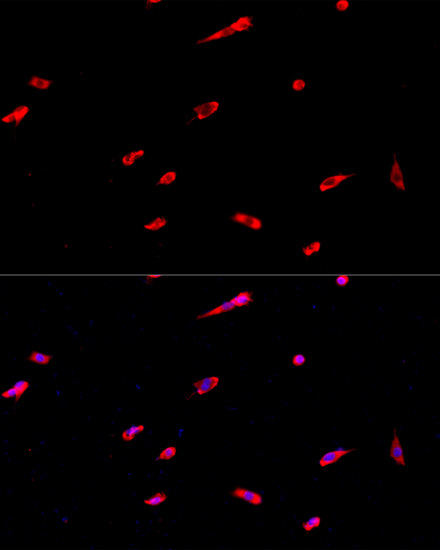 EIF3J Rabbit Polyclonal Antibody - Image 4
