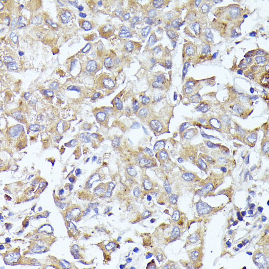 EIF3L Rabbit Polyclonal Antibody - Image 2