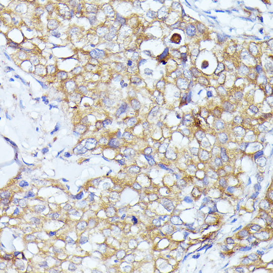 EIF3L Rabbit Polyclonal Antibody - Image 3