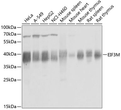 EIF3M Rabbit Polyclonal Antibody
