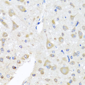 EIF3M Rabbit Polyclonal Antibody - Image 4