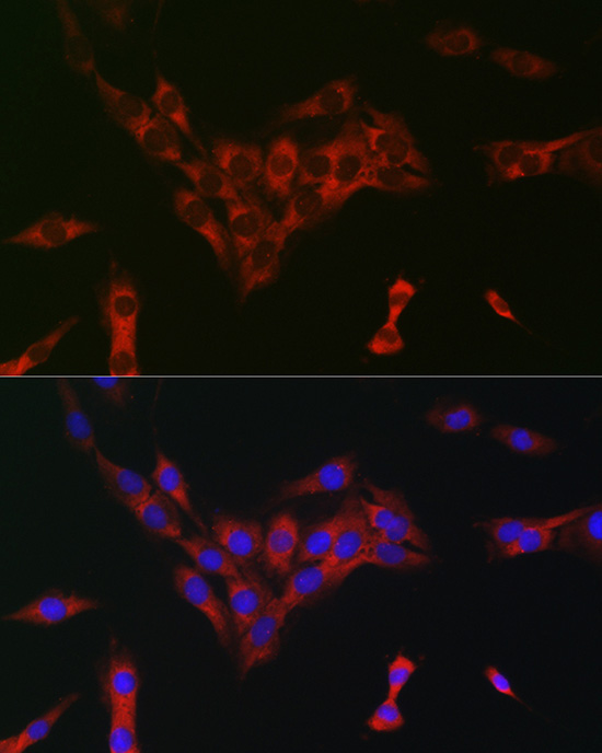 eIF4A Rabbit Polyclonal Antibody - Image 2