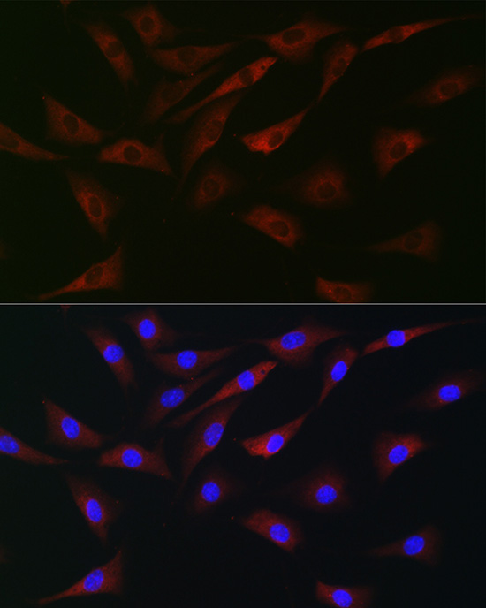 eIF4A Rabbit Polyclonal Antibody - Image 3