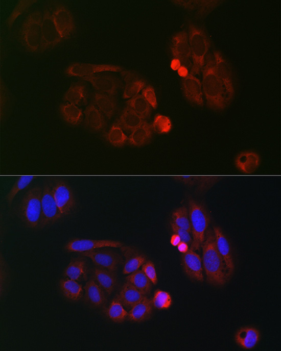 eIF4A Rabbit Polyclonal Antibody - Image 4