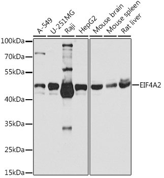 EIF4A2 Rabbit Polyclonal Antibody