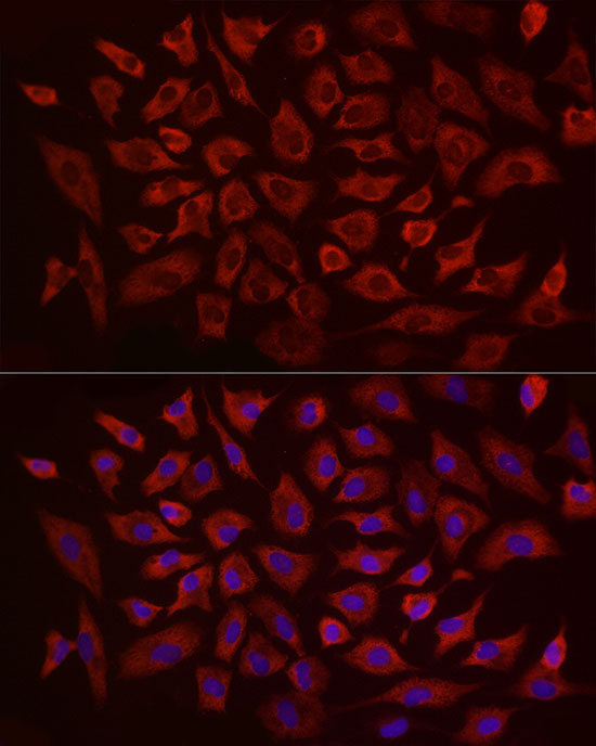 EIF4B Rabbit Polyclonal Antibody - Image 3