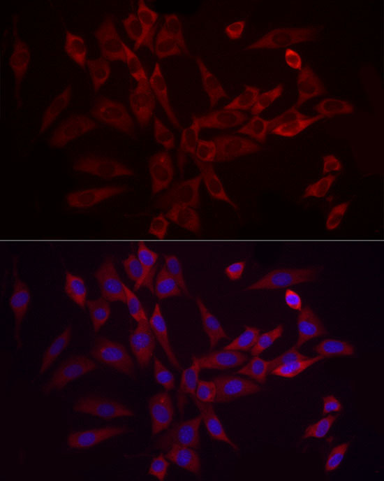 EIF4B Rabbit Polyclonal Antibody - Image 4