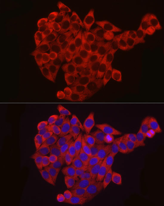 EIF4B Rabbit Polyclonal Antibody - Image 5